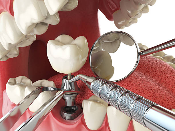 Best Orthodontic Emergency Dentist in Upland, CA